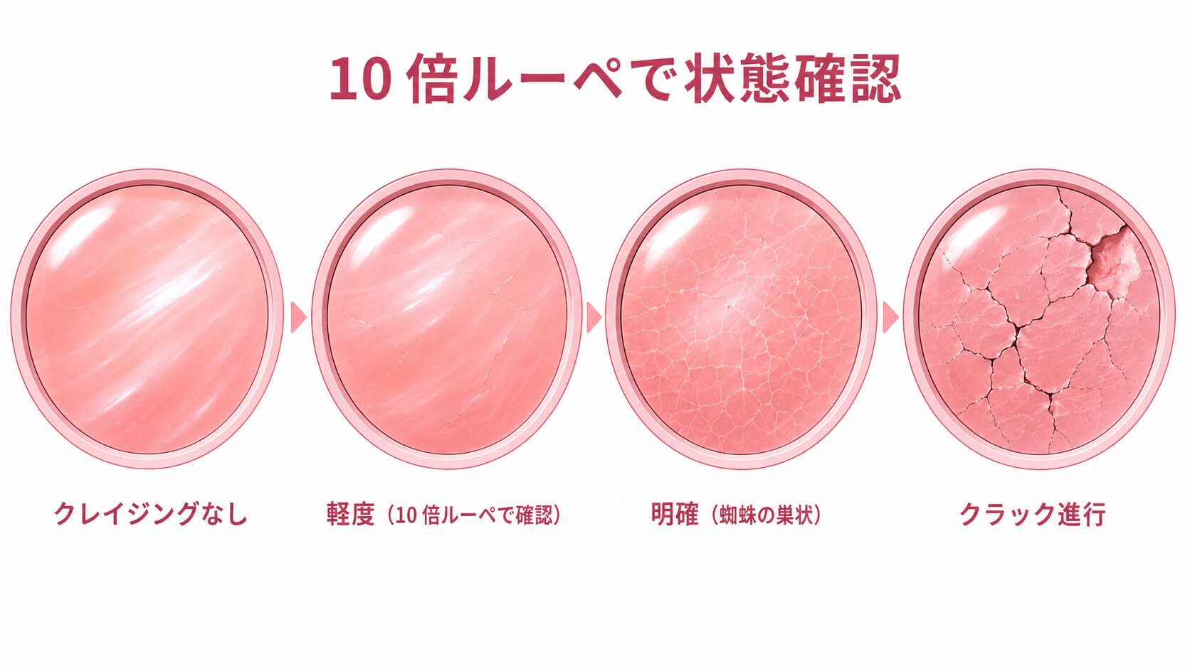 コンクパールの表面に発生するクレイジング(微細なひび割れ)の拡大ビューと進行段階。